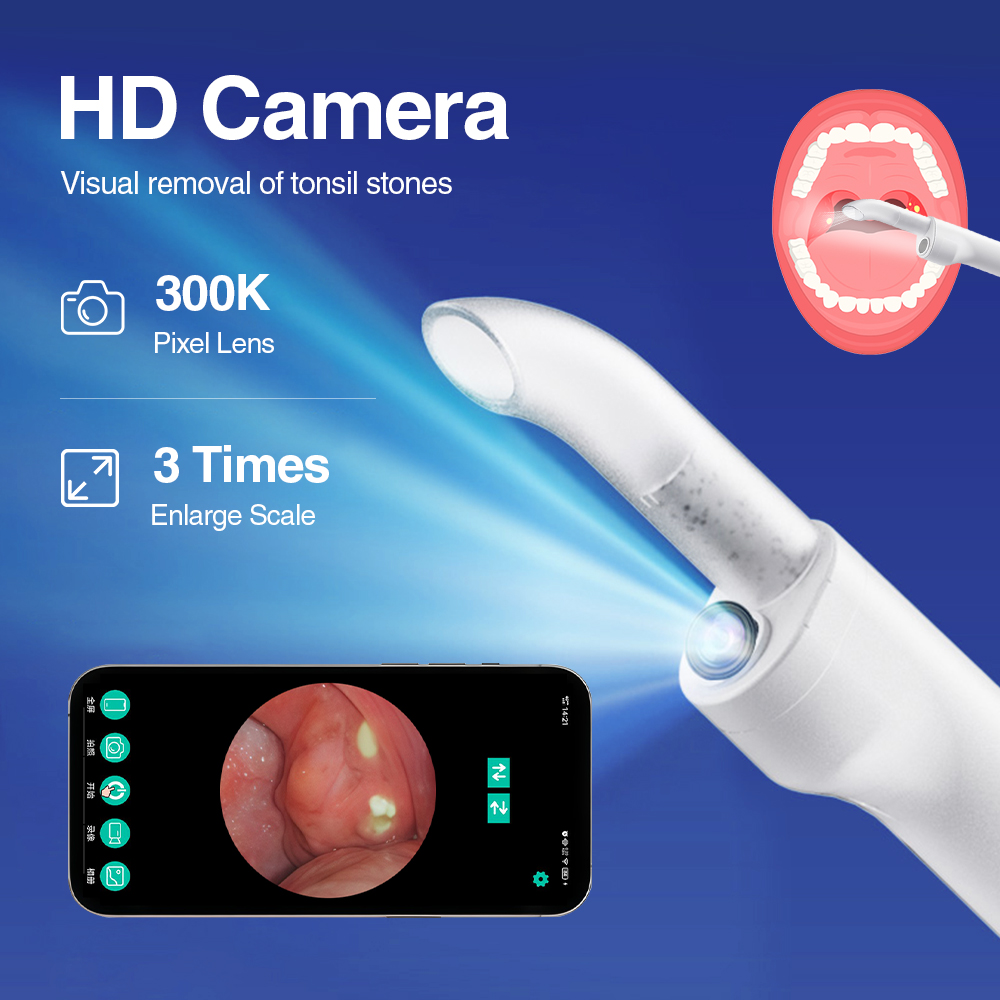 Smart Visual Tonsil Stone Remo - Lighting Visual recension och pris