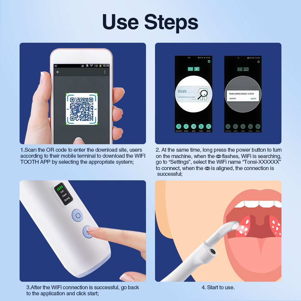 Smart Visual Tonsil Stone Remo - Lighting Visual recension och pris