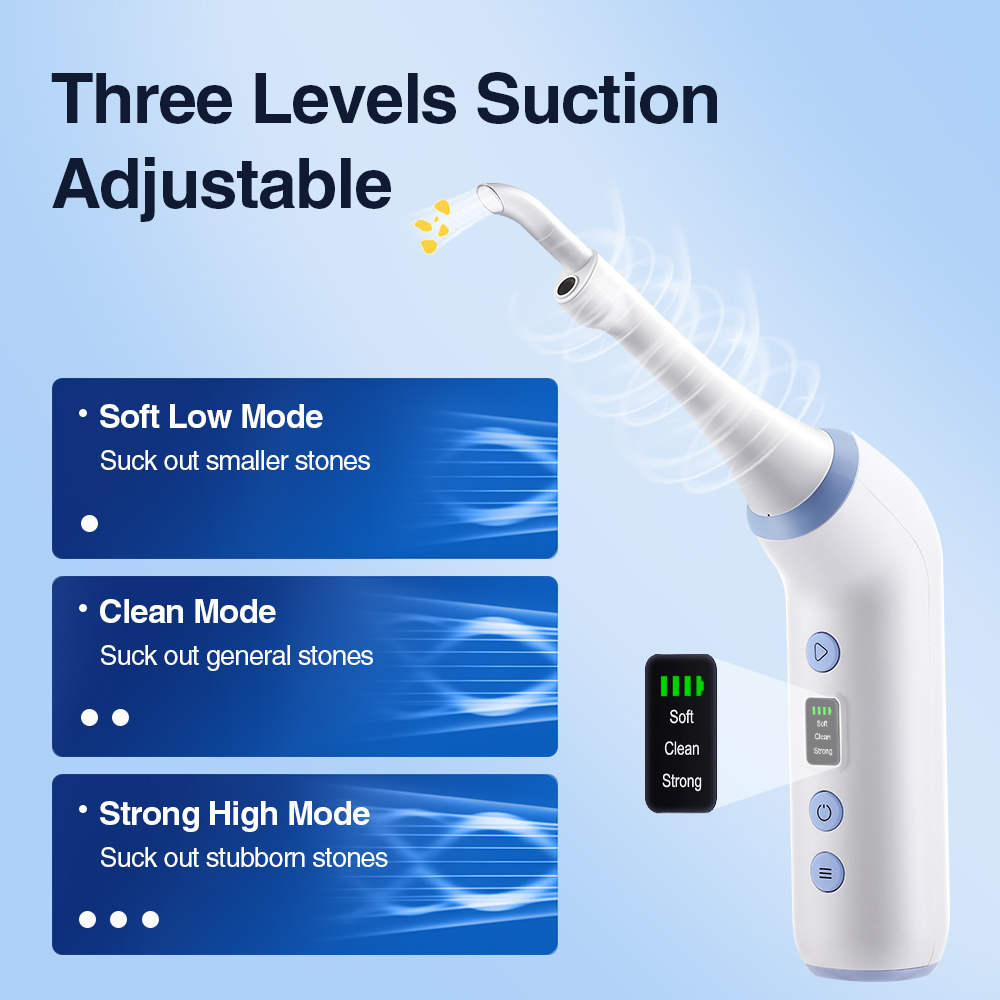 Smart Visual Tonsil Stone Remo - Lighting Visual recension och pris